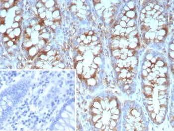 STMN1 Antibody / Stathmin 1