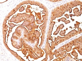 MUC1 Antibody / Mucin-1