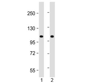 ALP Antibody / N-acetyltransferase-like protein / NAT10 (N-Terminal Region)