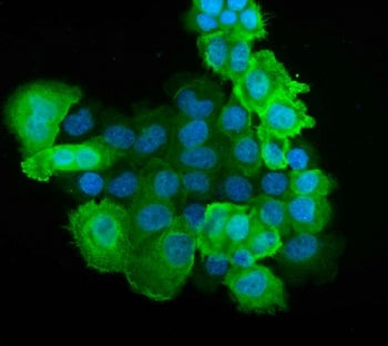 Immunofluorescent staining of FFPE human A431 cells with S100A6 antibody (green) and DAPI nuclear st