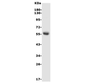 HEXA Antibody / Hexosaminidase A
