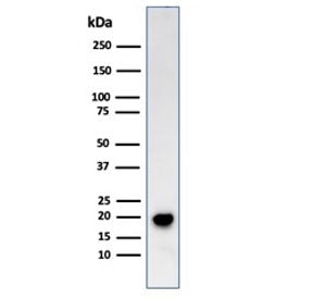 MART-1 / Melan-A Antibody