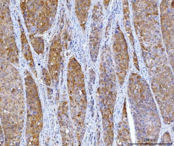 HGD Antibody / Homogentisate 1,2-dioxygenase