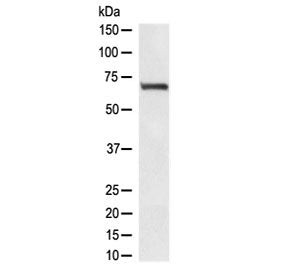 Western blot testing of human HEK293 lyaste with RPA70 antibody at 0.5ug/ml. Expected molecular weig