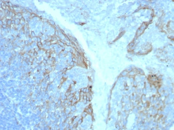 IHC staining of FFPE human tonsil tissue with CD54 / ICAM-1 antibody (clone ICAM1/8247R). HIER: boil