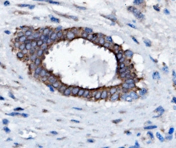 SLC25A1 Antibody