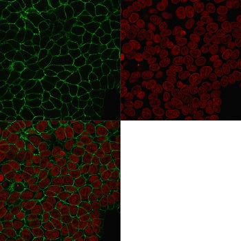 EpCAM Antibody