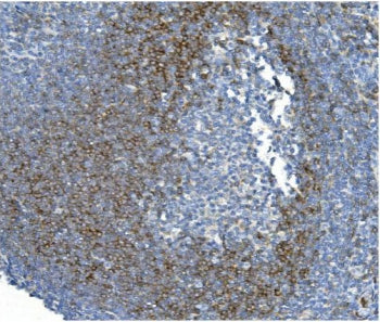 CD79b Antibody