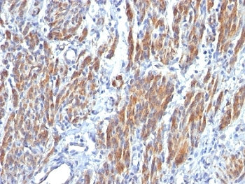 SMMHC Antibody (Smooth Muscle Myosin Heavy Chain)