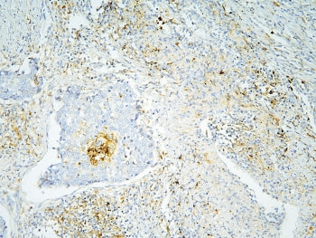 Annexin A3 Antibody