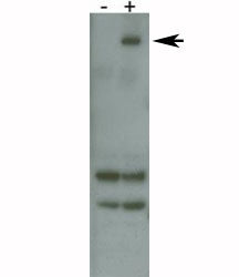 LRRK2 Antibody