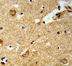 ENTPD2 Antibody