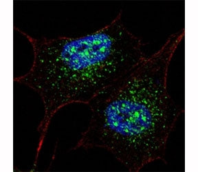 Fluorescent confocal image of SY5Y cells stained with NANOG antibody at 1:200. NANOG immunoreactivit