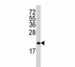 Western blot analysis of Fas antibody and T47D lysate. Predicted molecular weight: ~38 kDa (unmodifi