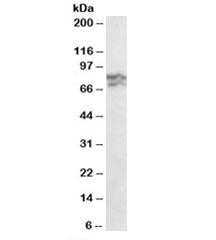 Western blot testing of HeLa lysate with RPA70 antibody at 0.3ug/ml. Expected molecular weight: ~70k