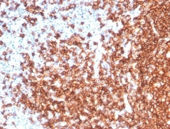IHC staining of FFPE human tonsil tissue with recombinant CD20 antibody (clone MS4A1/7015R). HIER: b