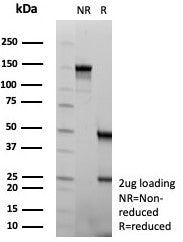 NSE Antibody / Neuron Specific Enolase
