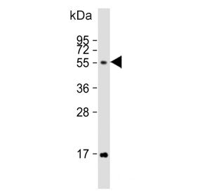 FUT6 Antibody