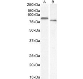 Western blot testing of A) human placenta and B) mouse kidney tissue lysate with Transglutaminase 2