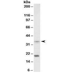 Western blot testing of mouse spleen lysate with HOXA9 antibody at 2ug/ml. Predicted molecular weigh