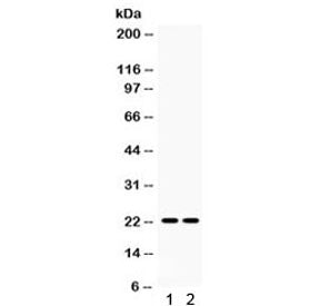 Lipocalin 2 Antibody / NGAL / LCN2