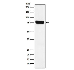 HEC1 Antibody / NDC80