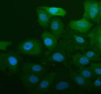 ALDH1A1 Antibody