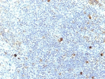 HLA-Aw32 + HLA-A25 Antibody