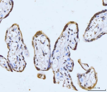 GHITM Antibody / MICS1