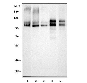 Western blot testing of 1) human SH-SY5Y, 2) human HepG2, 3) human HeLa, 4) rat brain and 5) mouse b