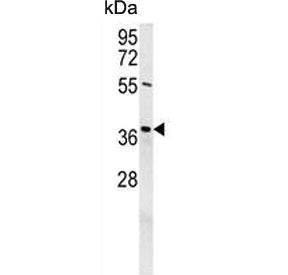 Exonuclease V / EXO5 / DEM1