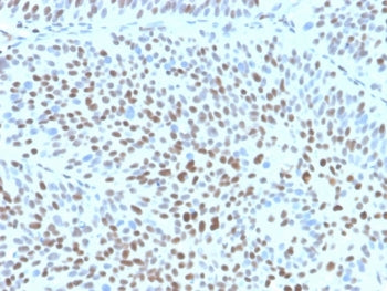 IHC staining of FFPE human bladder tissue with recombinant p27Kip1 antibody (clone clone KIP1/1355R)
