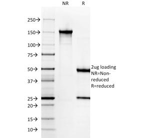 Gastrin Antibody