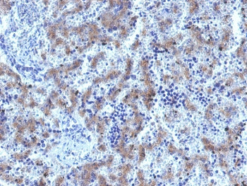 Glypican 3 Antibody / GPC3