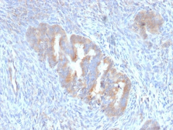 ATG5 Antibody