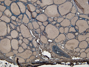 ENPP1 Antibody