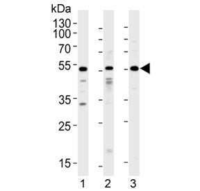 ACVR1 Antibody / ALK2