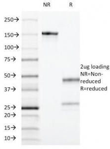 CD55 Antibody