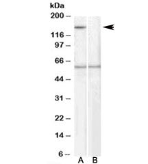 Western blot testing of human EBV-immortilized lymphoblastoid lysate with SIPA1 antibody at 1ug/ml,