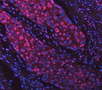 Sm-D2 Antibody / SNRPD2