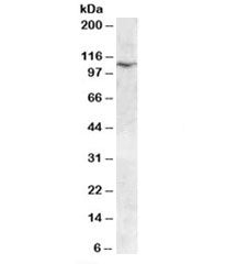 Western blot testing of human placenta lysate with TRPC6 antibody at 0.03ug/ml. Predicted molecular