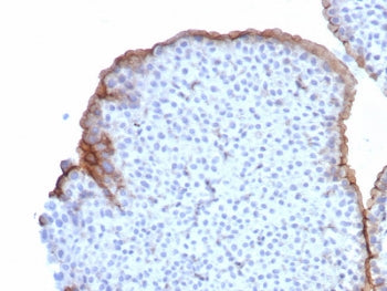 IHC staining of FFPE human bladder tissue with Uroplakin 3B antibody (clone UPK3B/8550R). HIER: boil