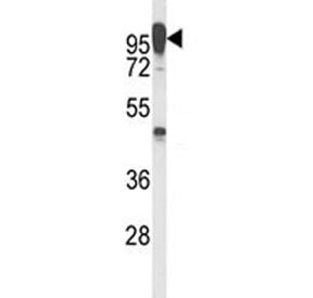 Western blot analysis of anti-LAMP2 antibody and T47D lysate. The protein can be extensively glycosylated and visualized from 45~110 kDa.