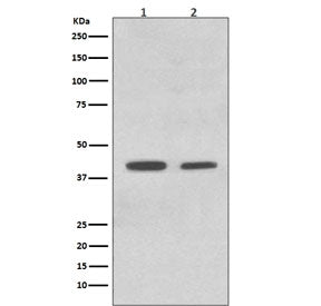 ACADM Antibody / Mcad