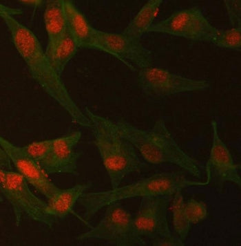 SMCHD1 Antibody / KIAA0650