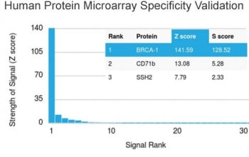 BRCA1 Antibody (Breast Marker)