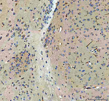 IHC testing of FFPE mouse brain tissue with Otoferlin antibody. HIER: Boil the paraffin sections in