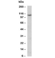 Thyroid peroxidase Antibody