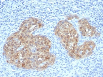 p16INK4a Antibody / CDKN2A