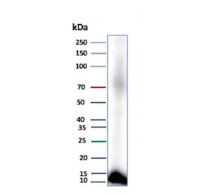 Western blot testing of human pancreas tissue lysate with CLPS antibody (clone CLPS/9021). Predicted